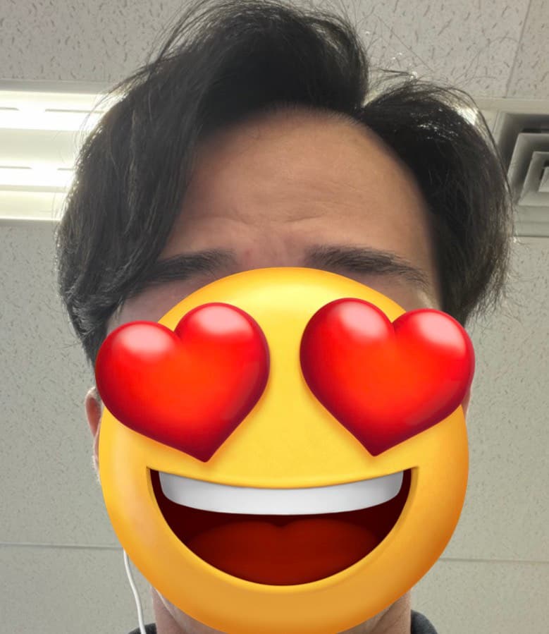 23歳現在の髪の状態